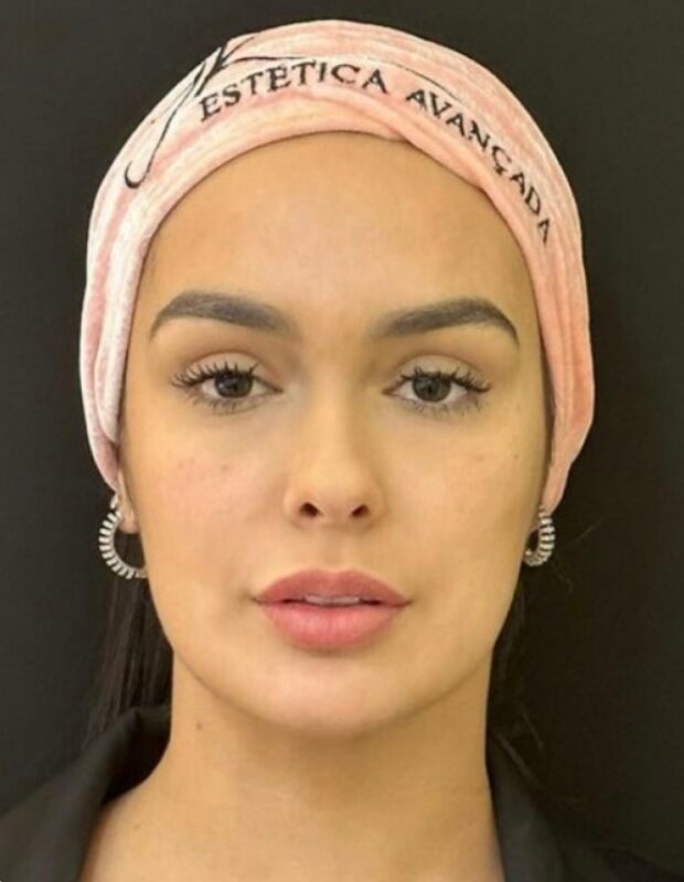 Catarina — antes do tratamento
